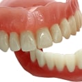 What is 3d smile design?