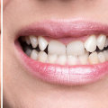 Who owns dental smiles?