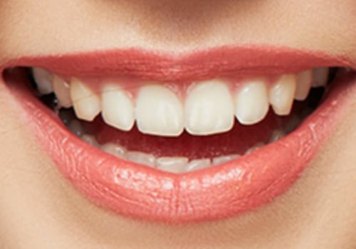 Can you eat with smiling teeth under pressure?